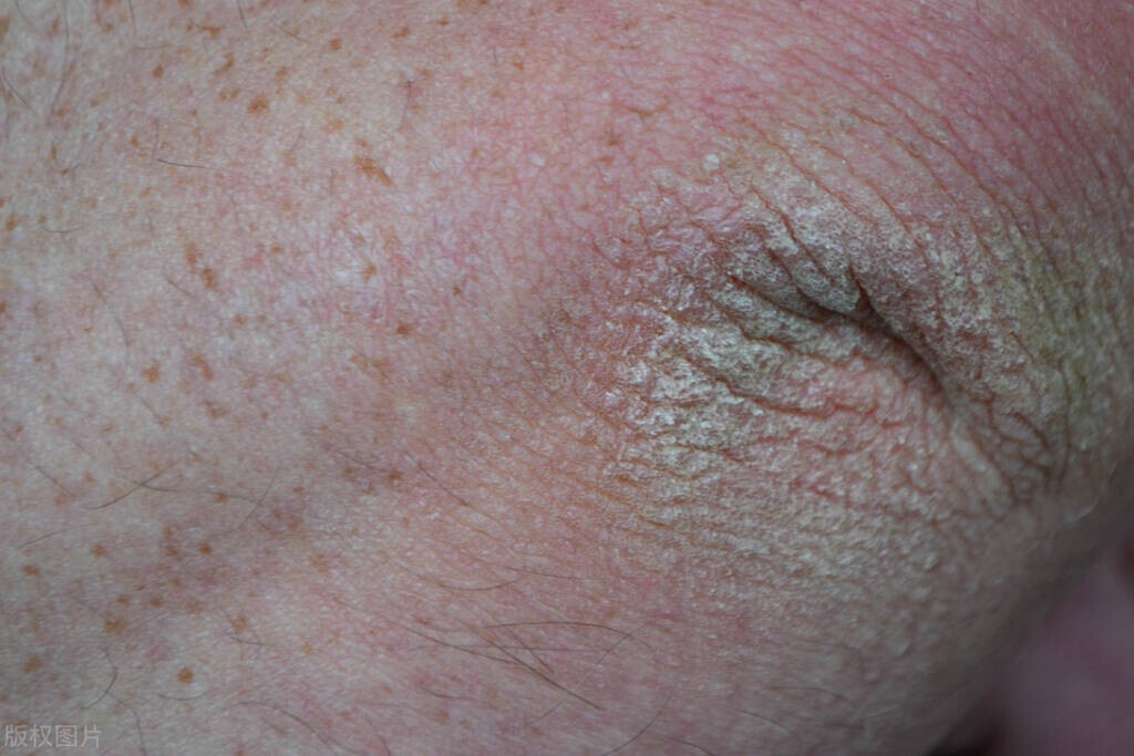 为何有些人“下面”没有毛？医生做了4点分析，男女都了解一下