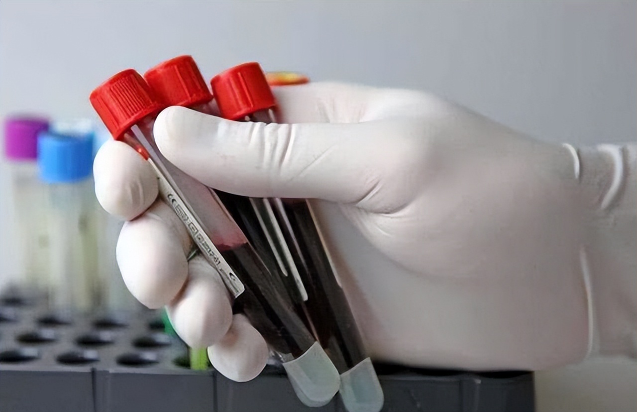 血常规里的指标低于多少需要治疗,血常规检查一些指标偏高一点点