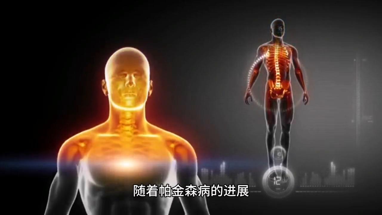 视频涨知识|帕金森病的治疗方法