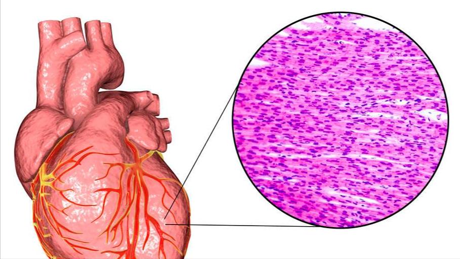 心肌修复与再生,修复心脏的最好方法