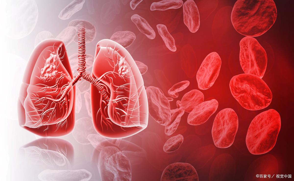 肺癌晚期呼吸困难会引起心衰吗,肺癌晚期胸积水呼吸困难怎么办