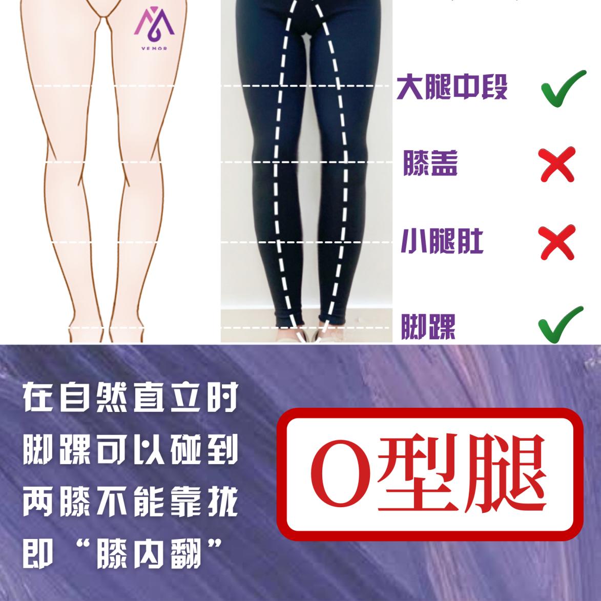 VEMOR变美干货|你了解你的腿形吗?