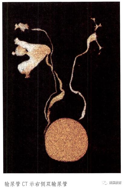 输尿管和髂血管解剖,脾胰解剖图