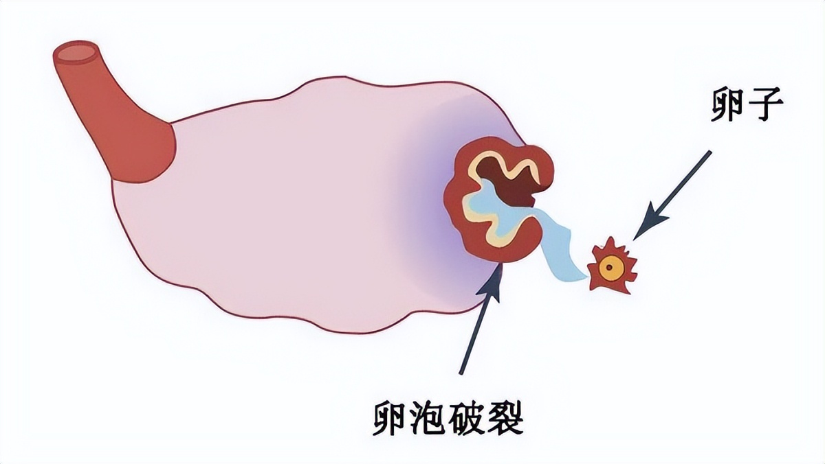 【健康】“大姨妈”又爱又恨，异常子宫出血到底是怎么回事？