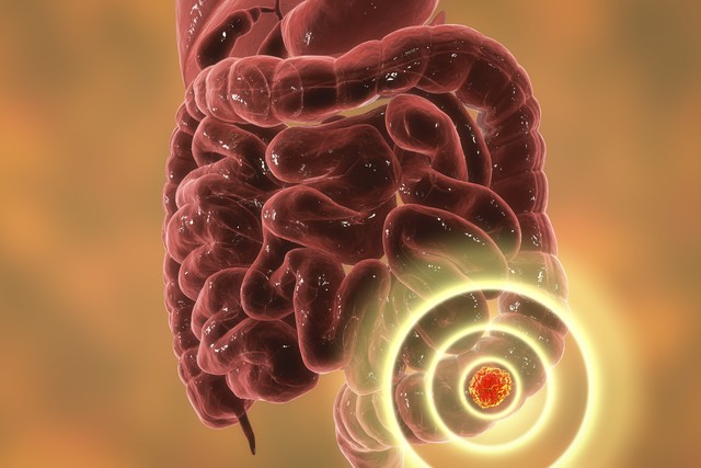 体检癌症筛查能检查出肠癌吗,每年体检查不出胃癌