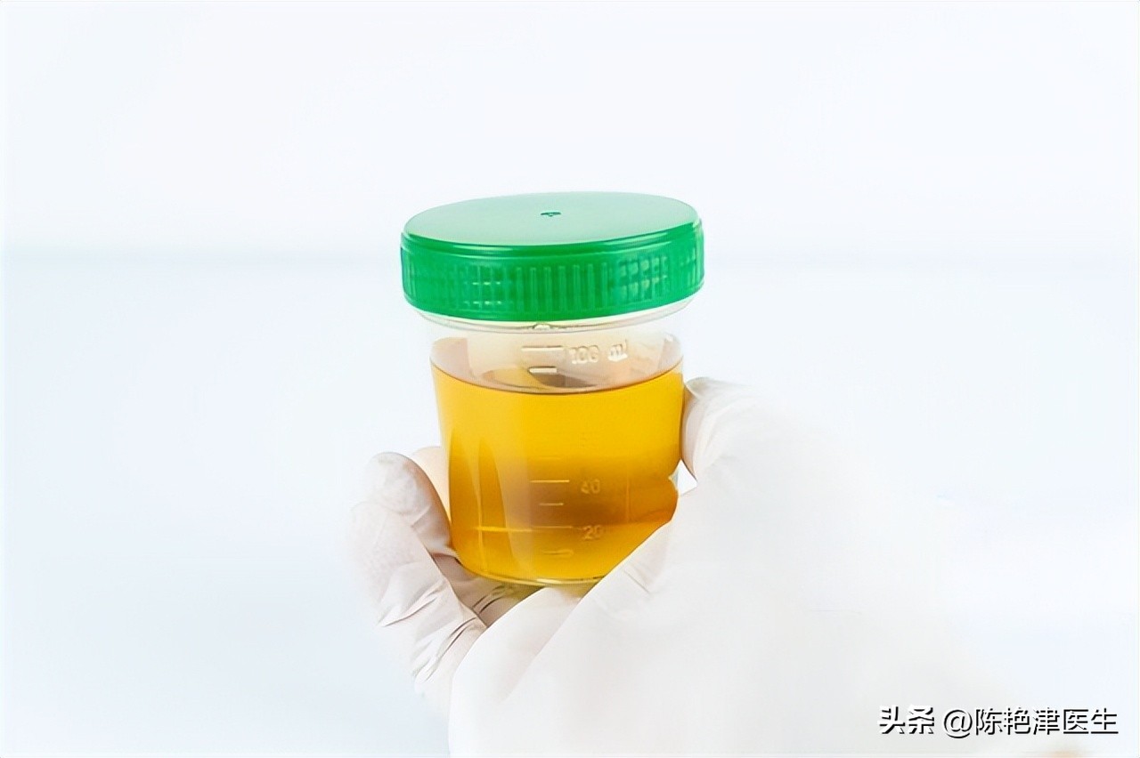 体检查出有肾结石要注意什么,体检有肾结石应该怎么处理