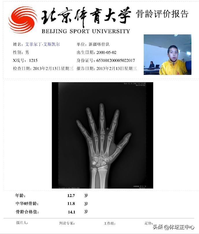 艾菲尔丁艾斯卡尔骨龄,艾菲尔丁回应骨龄