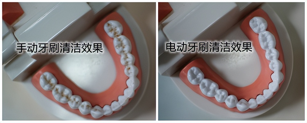 儿童电动牙刷一直用有什么危害,儿童电动牙刷的好处和危害