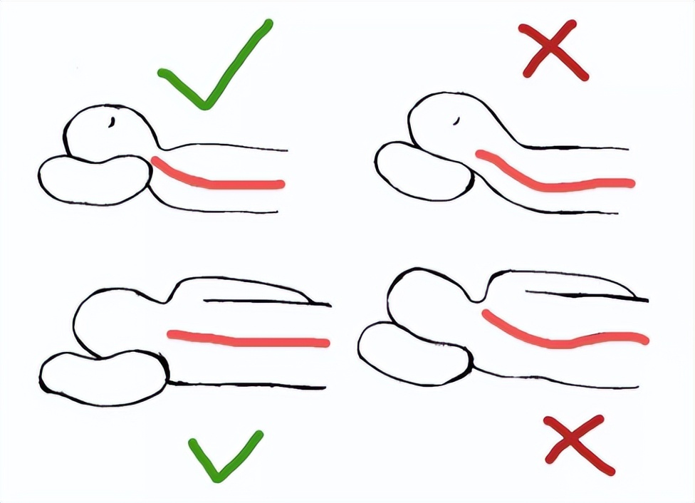 颈椎痛有没有什么老土方法治疗,颈椎痛的不能动了怎么按摩
