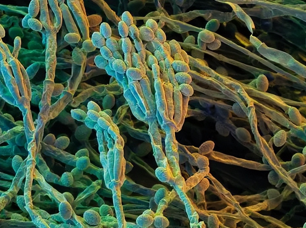 粮食中真菌的检测,粮食中真菌毒素检测的优缺点