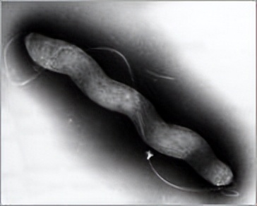 季节性食物中毒安全常识,大规模食物中毒的主要致命菌