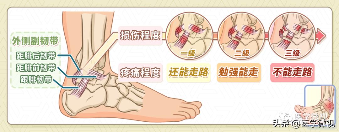 小心崴到脚,不小心崴到脚了为什么一直疼