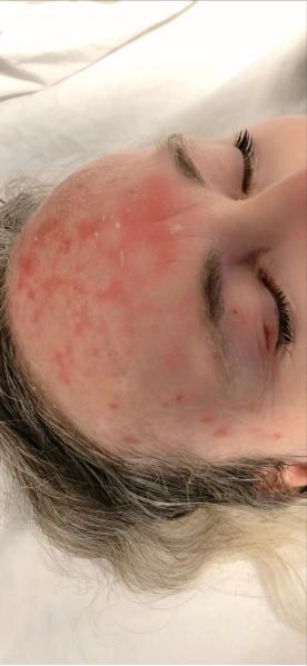 古派针灸法视频教学,古派针灸视频教程全集在线观看