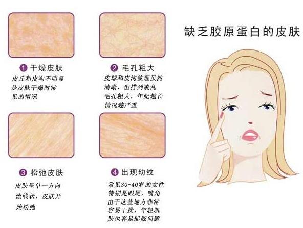 为什么吃甜食对心情好,吃甜食反而会让你心情变差