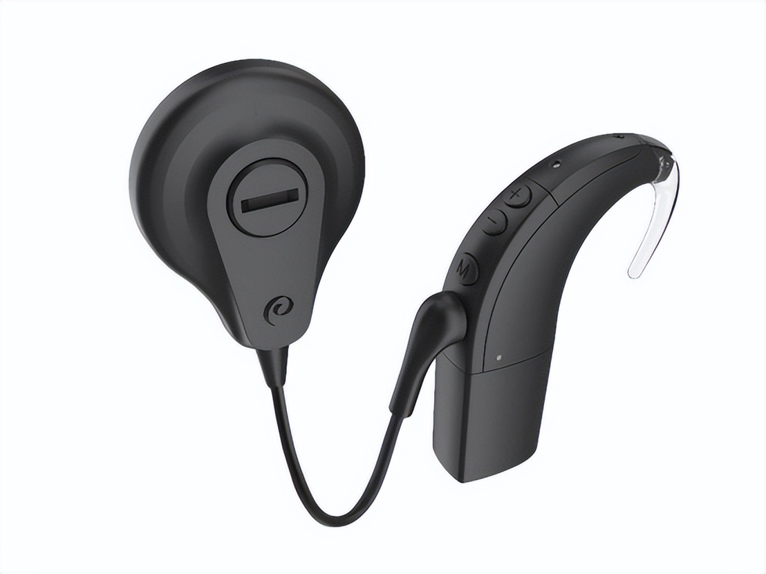 人工耳蜗进口的2023多少钱,国产人工耳蜗和进口差距