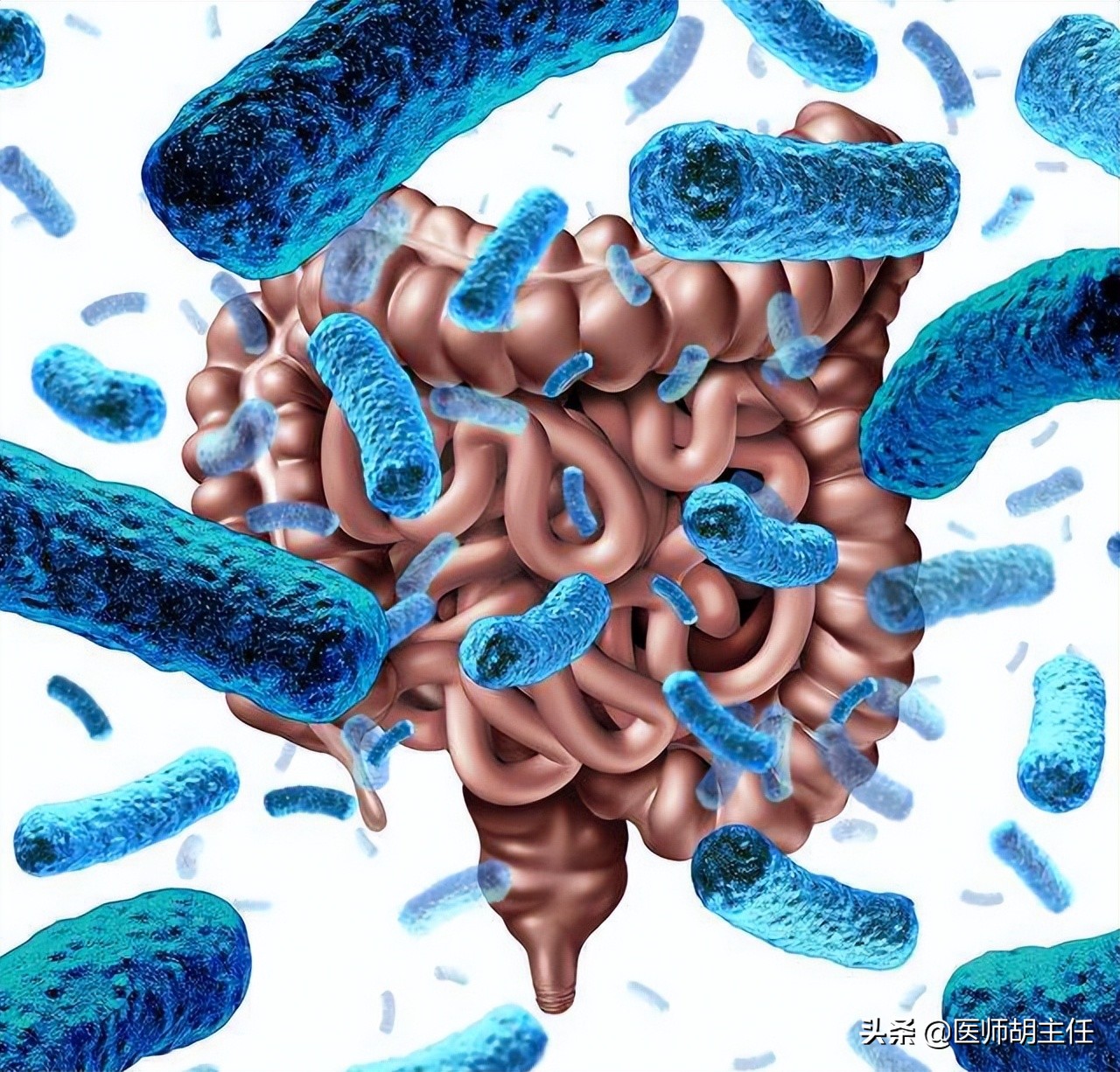 肠道有息肉会出现什么症状,肠道长了息肉有什么症状