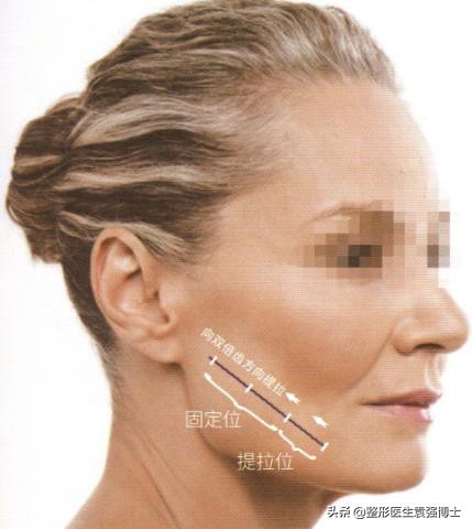 35岁了怎么改善松弛,35岁脸部紧致的10个训练