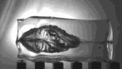 被子弹打中后怎么处理伤口,被子弹打中自己怎么处理