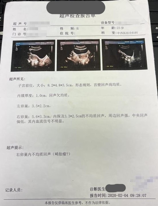 未婚女得卵巢畸胎瘤正常吗,未婚女性得了畸胎瘤怎么办