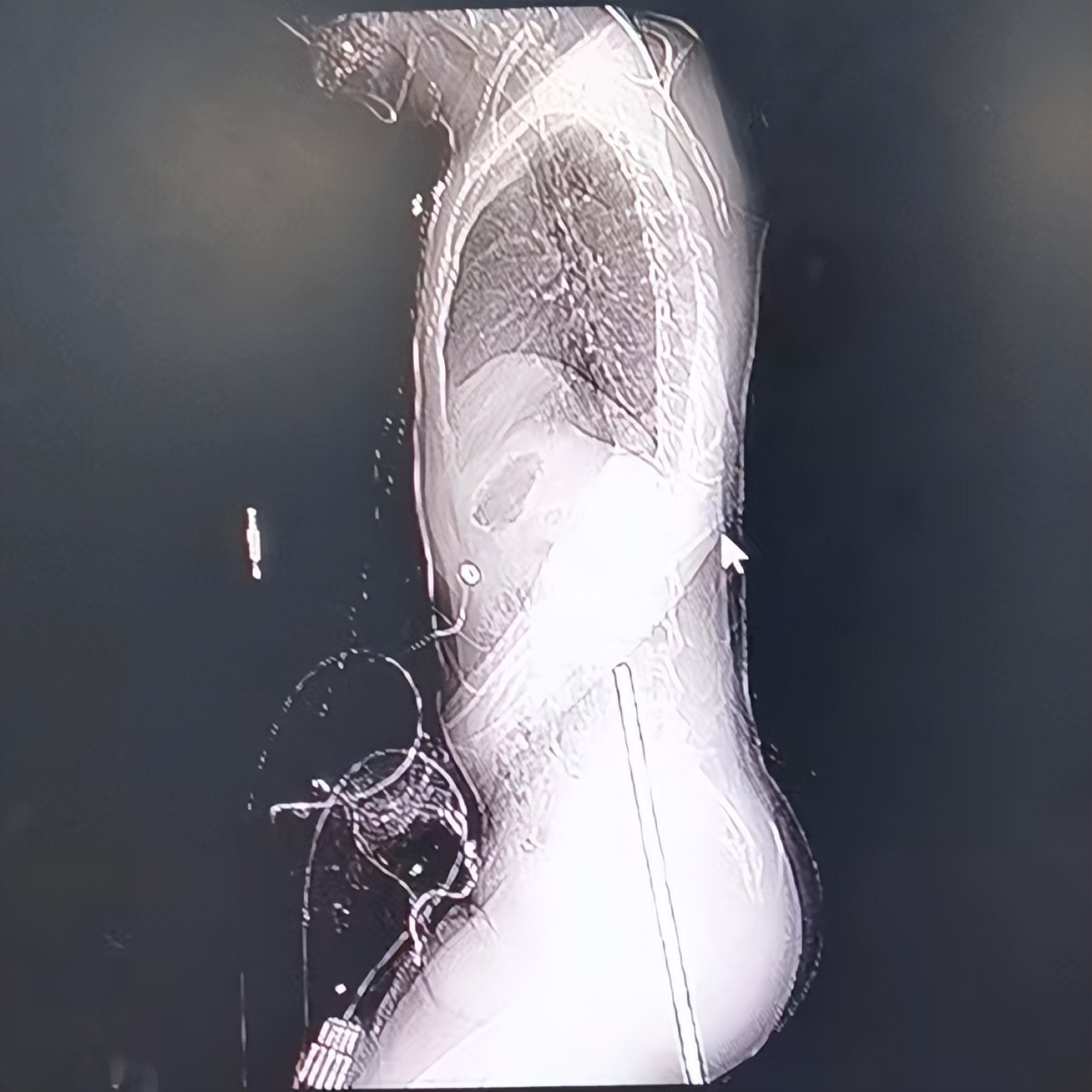 福州一名男子从19楼跳下,福州男子坠落