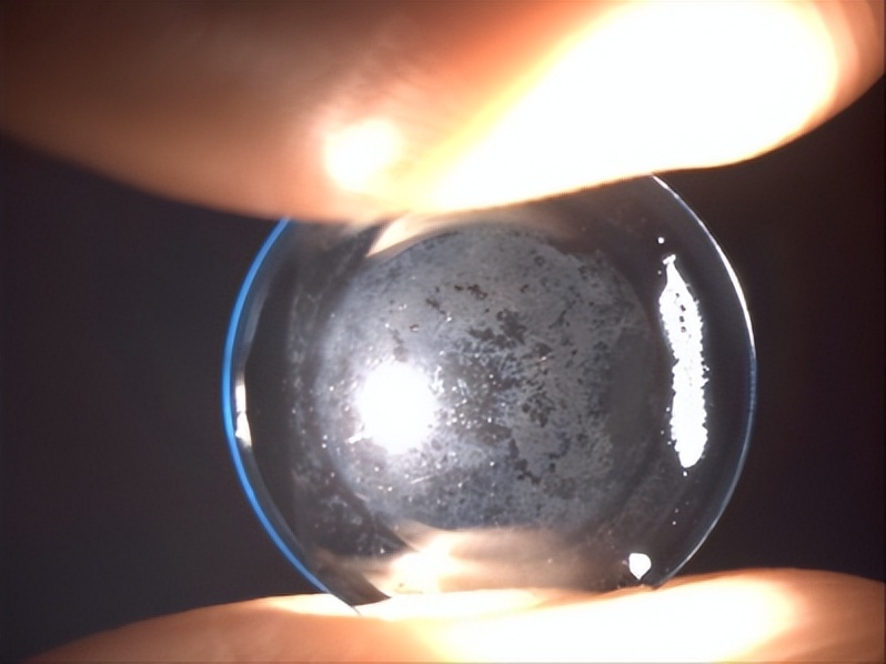 角膜接触镜验配案例图解,戴角膜塑形镜反复出现点染的原因