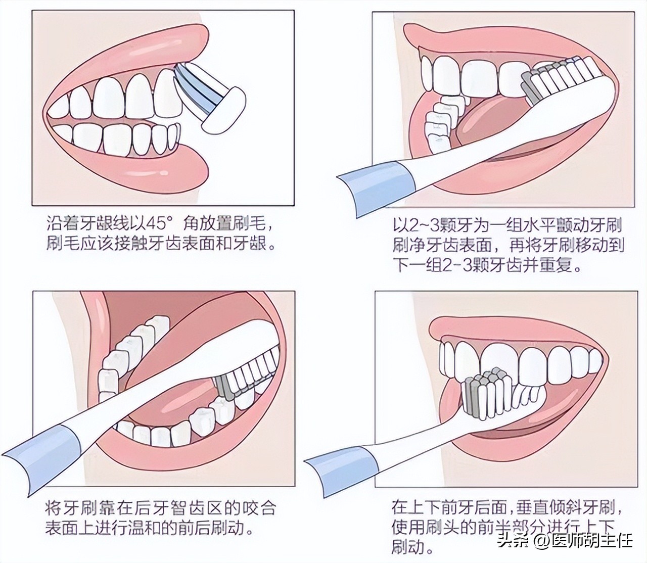 有一种痛叫口腔溃疡,有一种痛叫口腔溃疡动画片