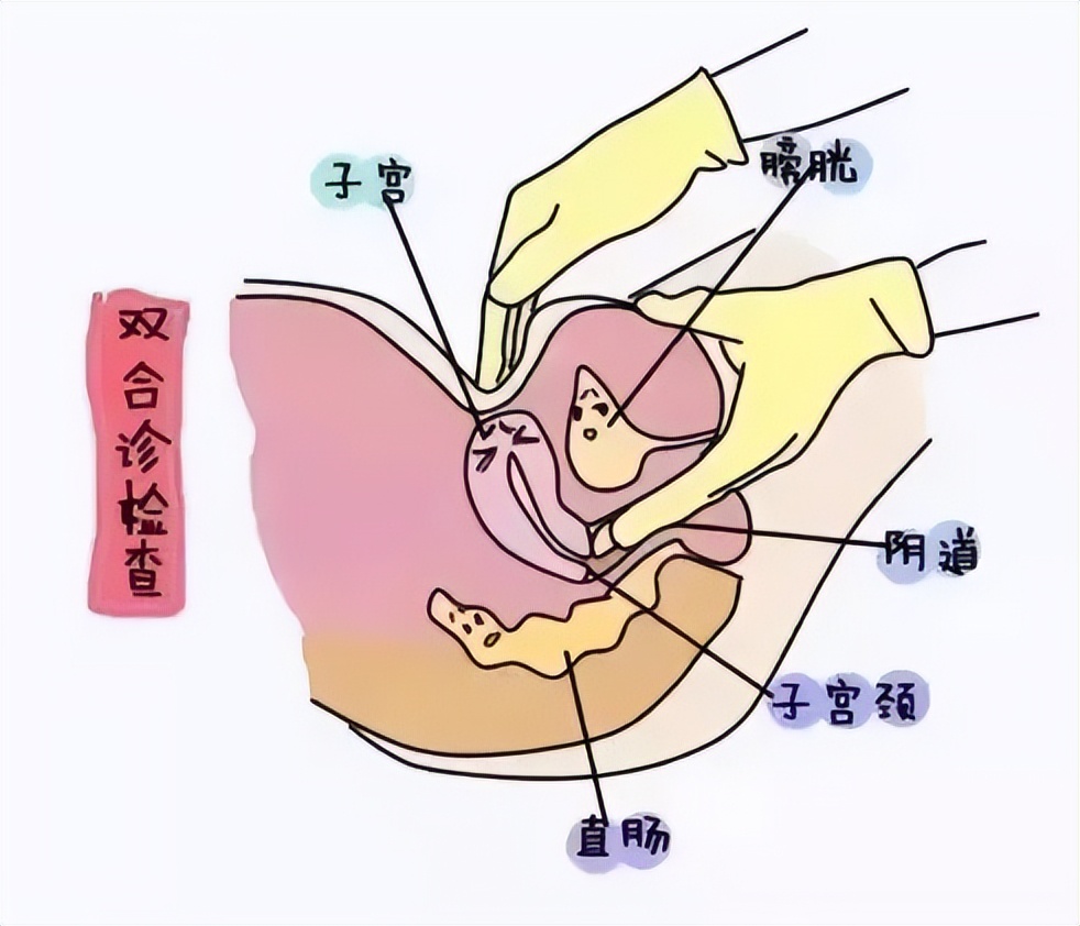 女性预防妇科病的防护措施,呵护女性健康