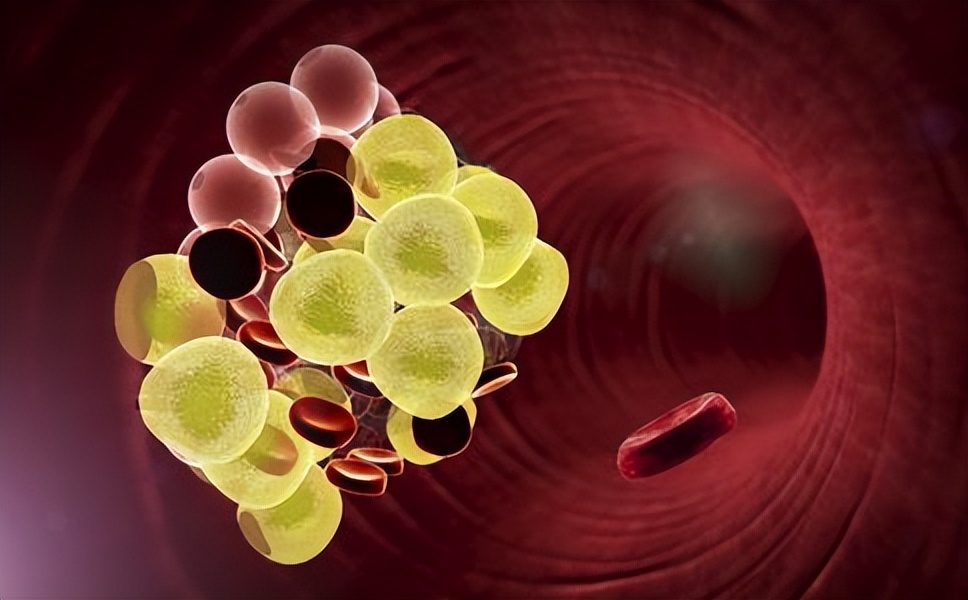 身体中转氨酶高的表现,血液中转氨酶过高是什么原因