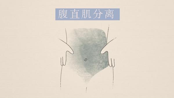 腹直肌分离怎么激活腹肌,腹肌腹直肌分离的讲解