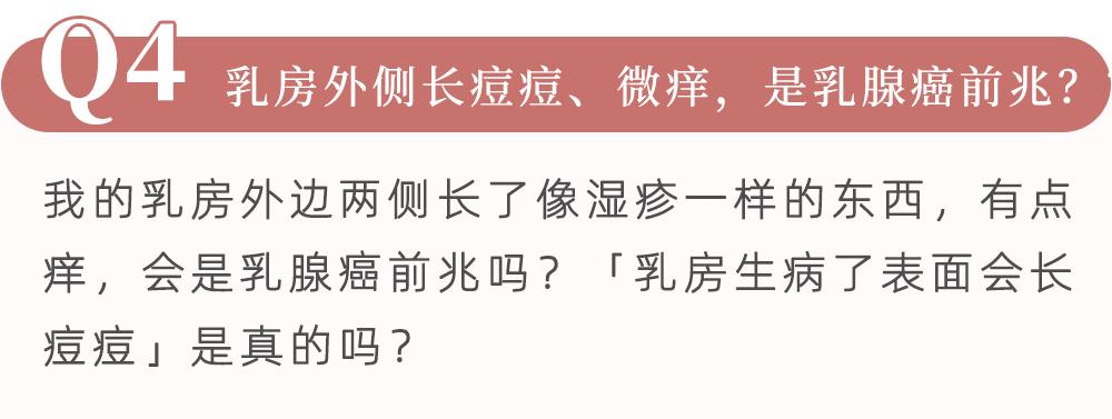 乳房有什么症状了需要做检查,乳房出现哪些症状需要就医