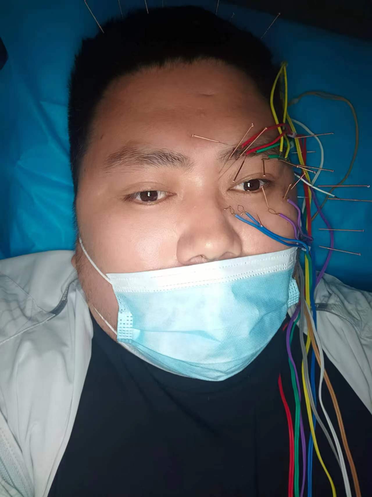 80后中年脑出血,80后的脑出血