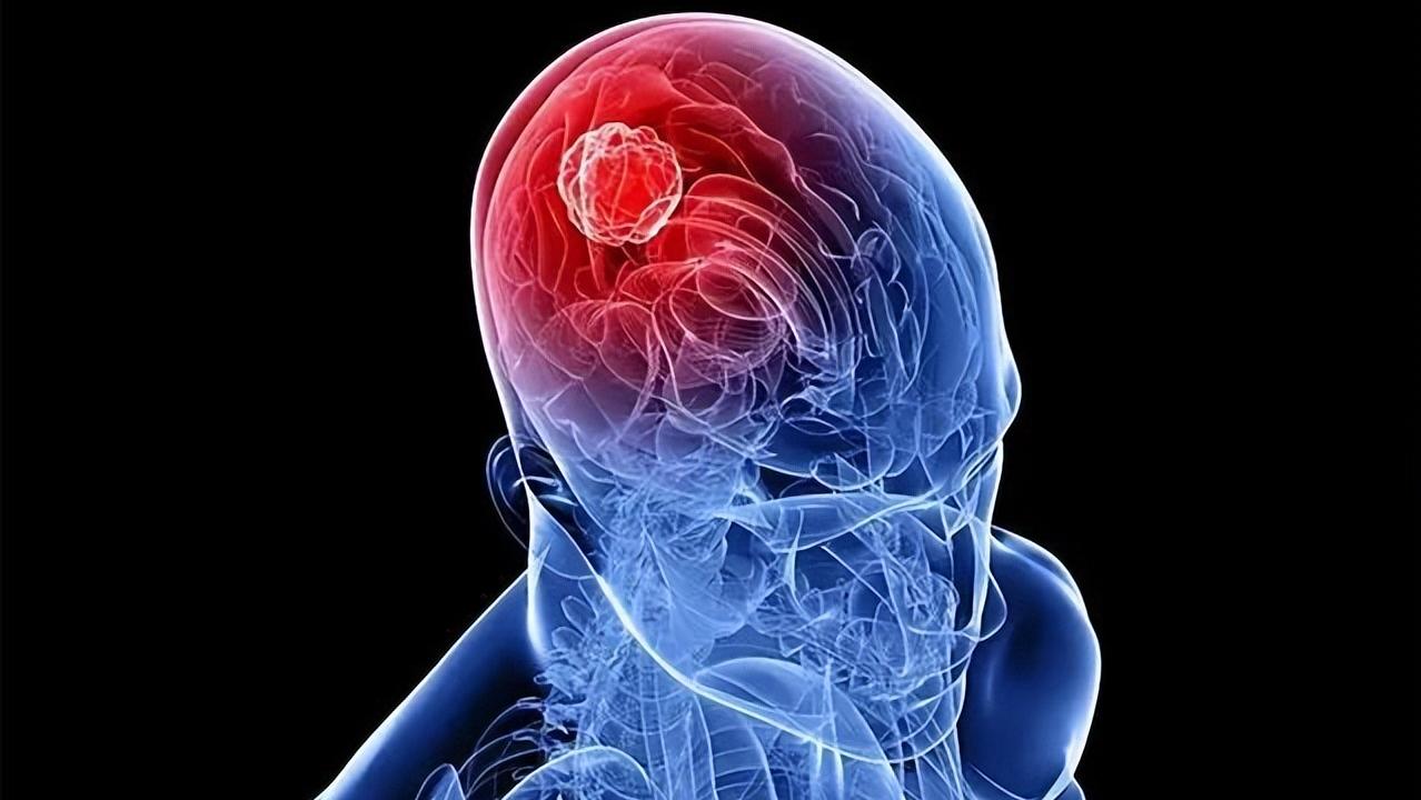 闭经是不是指一直没来,为何女性容易出现月经不调的问题