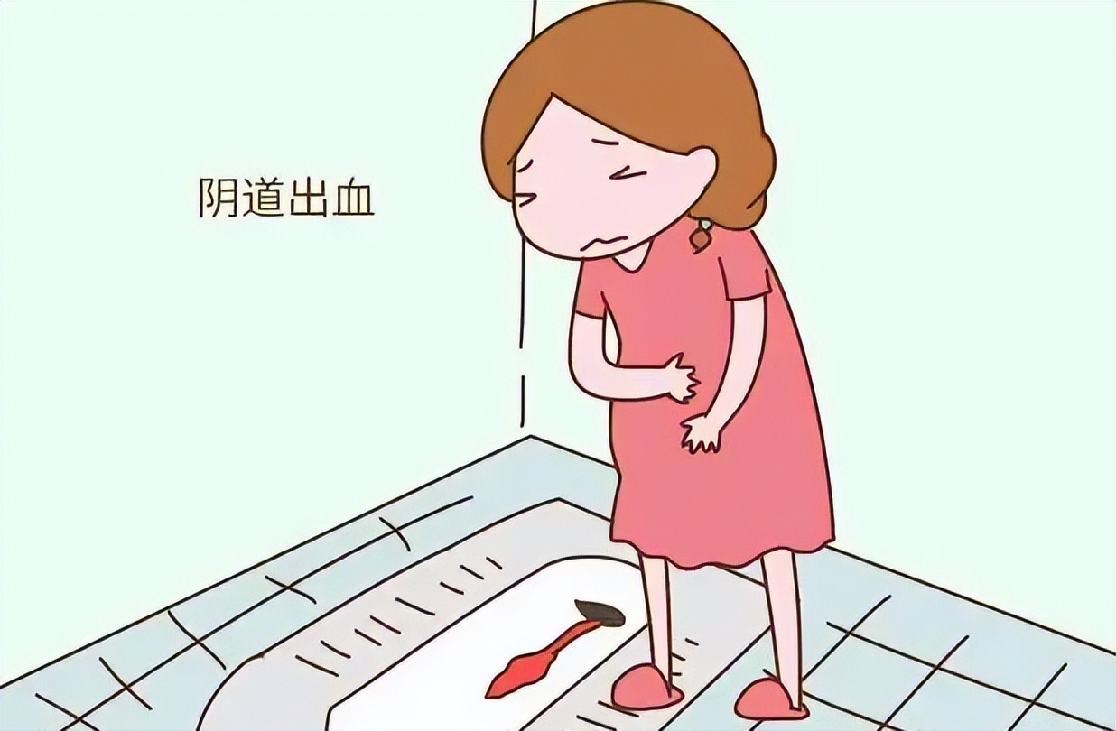 宫外孕腹腔出血的真实经历,医学科普宫外孕知识分享