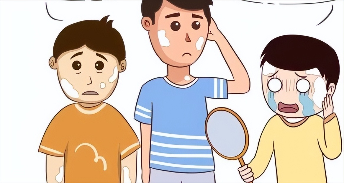 你的白癜风恢复到什么程度？这些参考可以评估