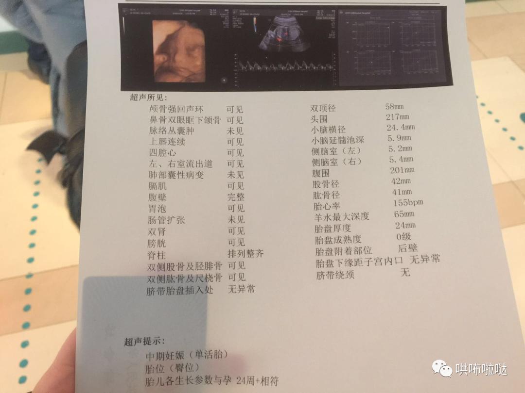 怀胎十月终于要卸货,回忆一下刚出生的宝宝