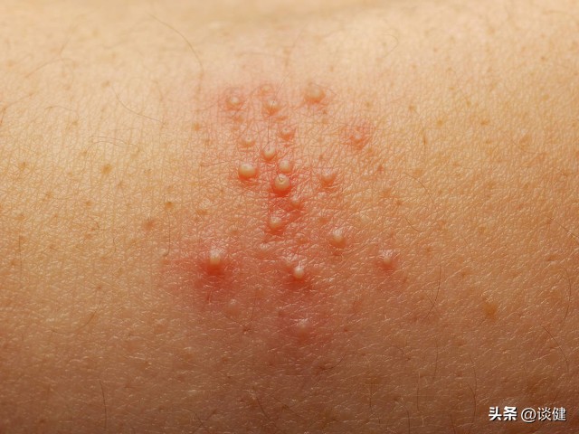 阴道痒分泌物多什么症状,阴道痒没有分泌物是什么症状