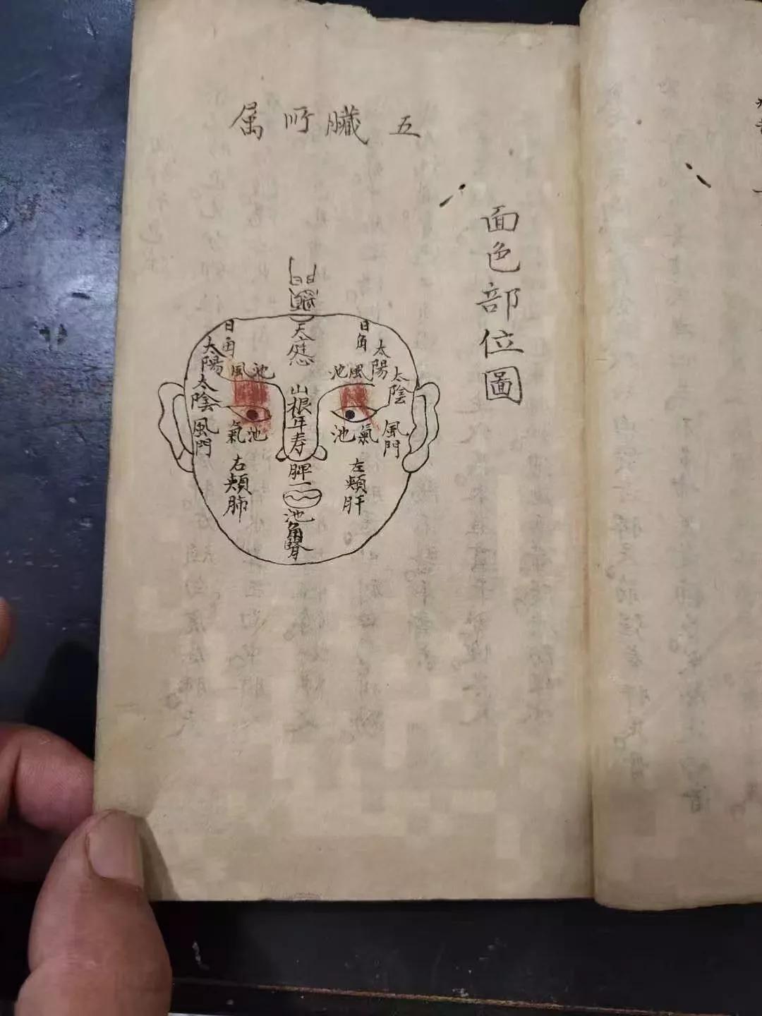 火灸疗法的书,藏医火灸疗法书