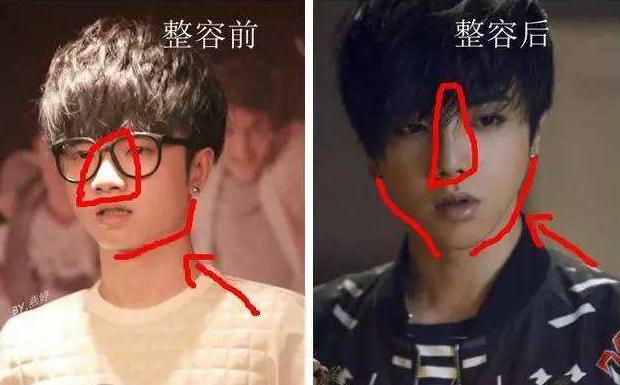 有一种倔强叫做没整容,有种倔强叫不承认整容