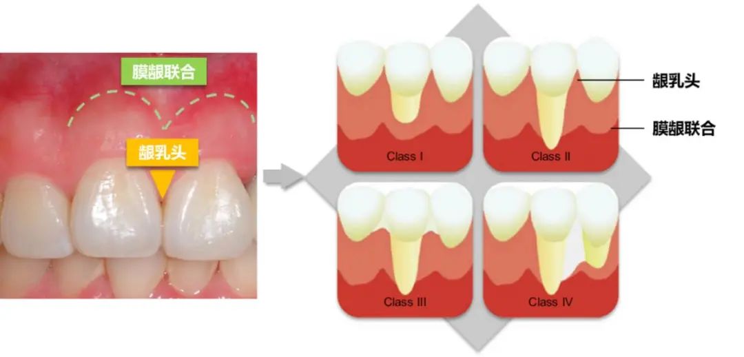 怎么拯救脱发小仙女,如何拯救牙齿上的黑洞