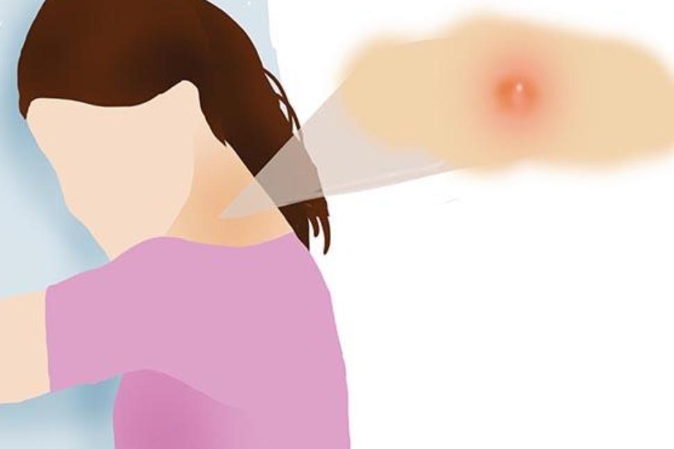 脖子上的小肉粒揪下去会变多吗,脖子腋下长小肉粒可以用手揪掉吗