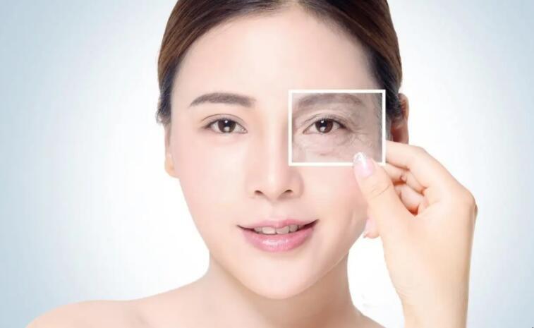 鱼尾纹是怎么引起的,什么叫鱼尾纹