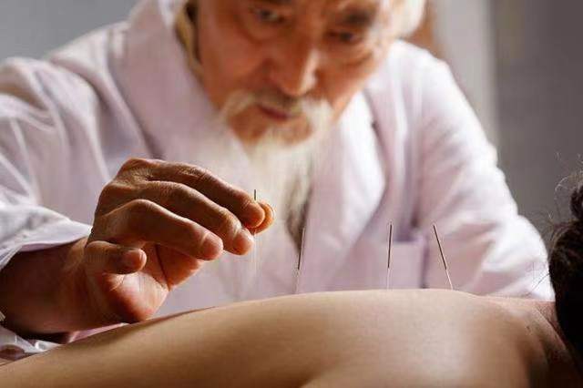 针灸以痛治痛原理,针灸入门练法