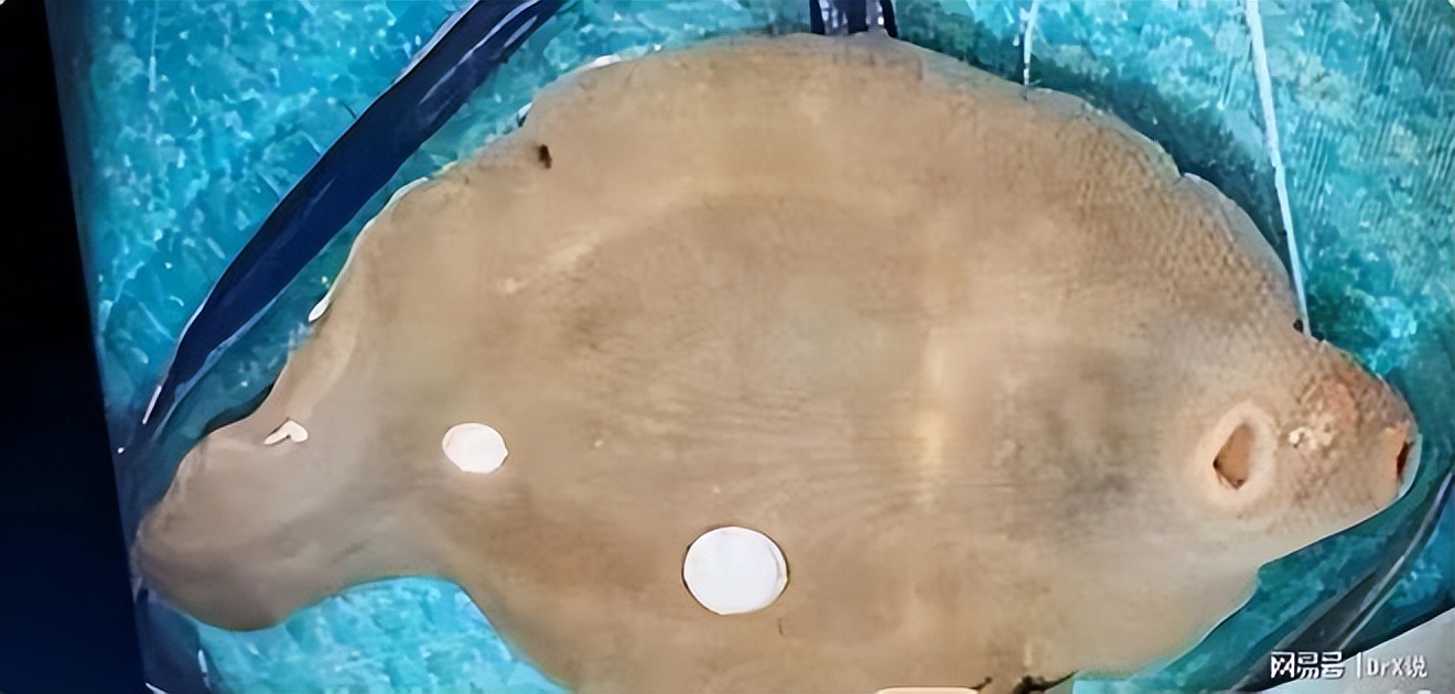 一男子吃生鱼片浑身寄生虫,一男子吃蔬菜导致全身都是寄生虫