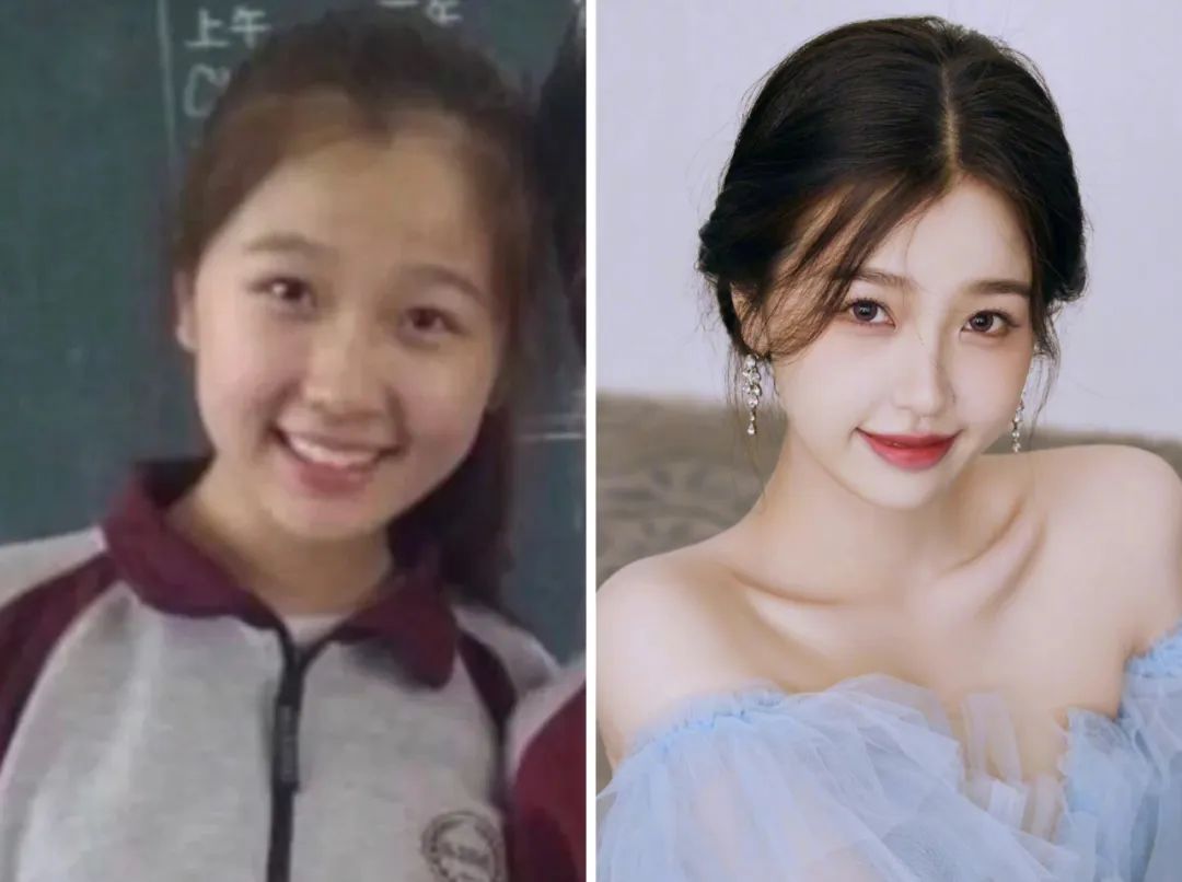 虞书欣圆脸变微脸的方法,虞书欣扁平脸改善