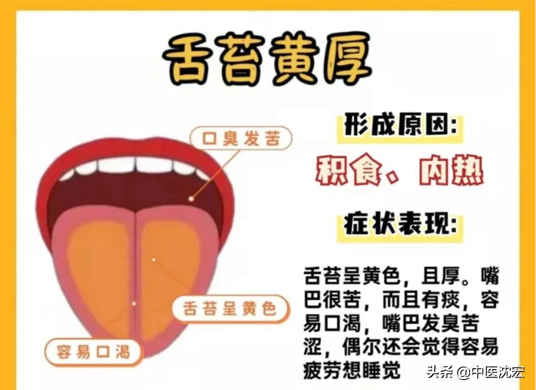 中医教你看舌头得知身体表现,中医看舌头舌苔图谱