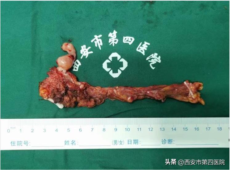 鍏ㄦ皯鍋ュ悍绱犲吇鎻愬崌璁″垝,鍏ㄦ皯鍋ュ悍姘村钩鎻愬崌琛屽姩璧勬枡