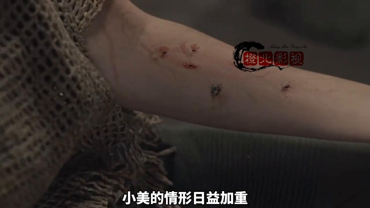 女子被真菌感染眼球变异,女人真菌感染后怕不怕