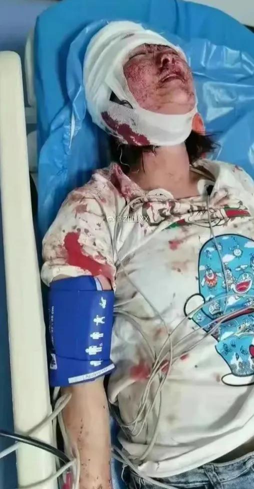 唐山暴力殴打女孩现状,唐山暴力打女孩