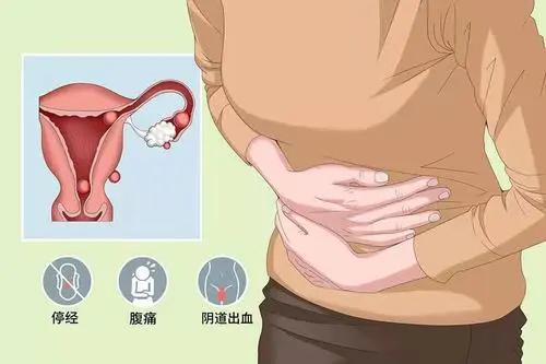 怀孕前期会腹痛,怀孕早期肚子痛就一定是宫外孕吗