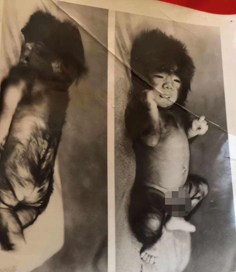 当年轰动一时的“毛孩”：42岁娶90后娇妻，生下一子未遗传长毛